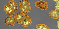 Neisseria gonorrhoeae
