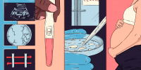 Illustration with several panels. On the far left, three small boxes with images of a sonogram, a broken petri dish, and two test tubes being swapped, respectively. Middle left, a hand holding a negative pregnancy test. Middle right, a pair of hospital doors with a "closed" sign on the front, and a gloved hand holding a petri dish and dropper tool. Far right, a pregnant woman holding her stomach. 
